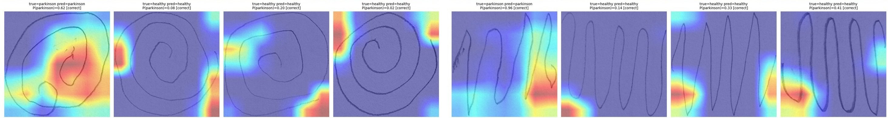 Eight Grad-CAM overlays on spiral and wave drawings, with heat on the margins rather than the strokes